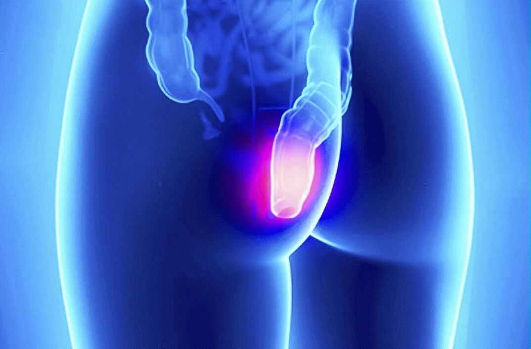 Gelarex kann souwuel extern wéi rectal benotzt ginn